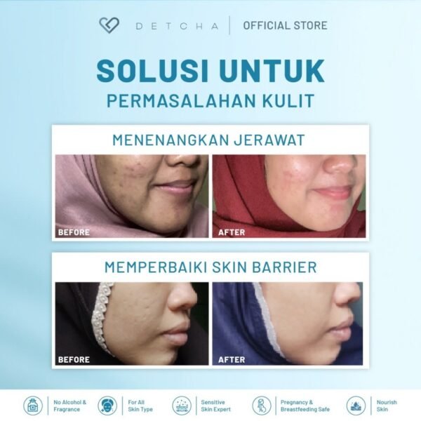 Detcha Calming Face Toner Menghidrasi Menenangkan dan Mencerahkan Kulit For Sensitive Skin Aman Untuk Bumil Busui - Gambar 2