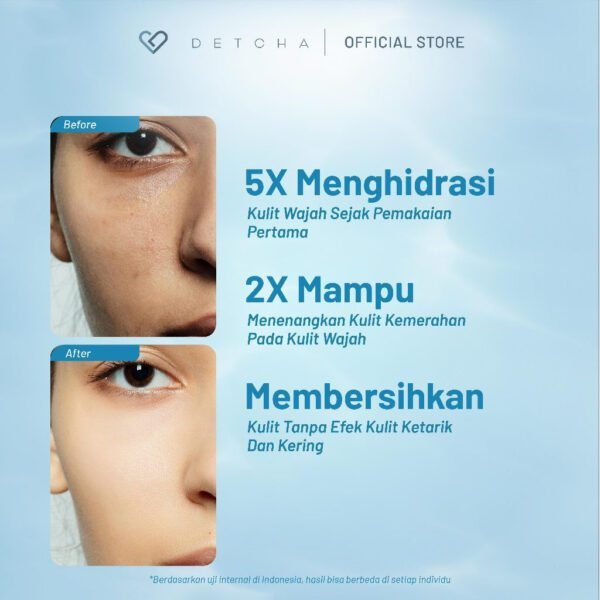 [2 Pcs] DETCHA Calming Facial Wash NON SLS 5X Menghidrasi Kulit Membersihkan Wajah Sampai Pori-pori - Gambar 6