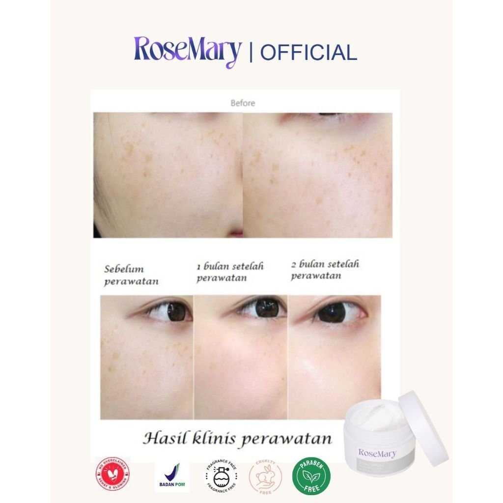 Rosemary Snow White Moisturizing Cream Mencerahkan Melembabkan Atasi Bekas Jerawat Flek Hitam - Gambar 6