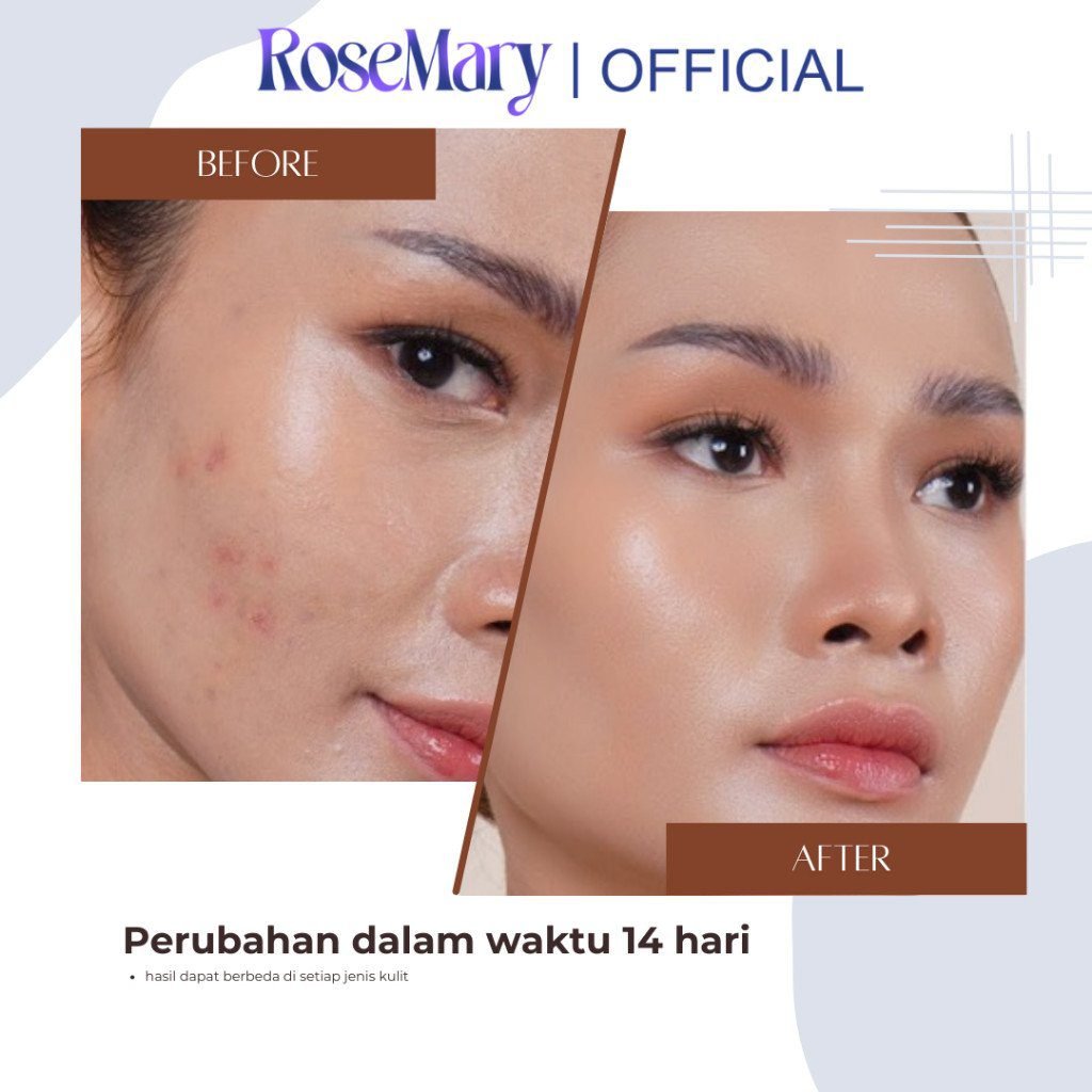 ROSEMARY AHA Ceramide Essence Toner 100 ml | Brightening Toner | Soothing Toner | Barrier toner | Exfoliating toner toner badan face mist hydrating AHA Toner - Gambar 3