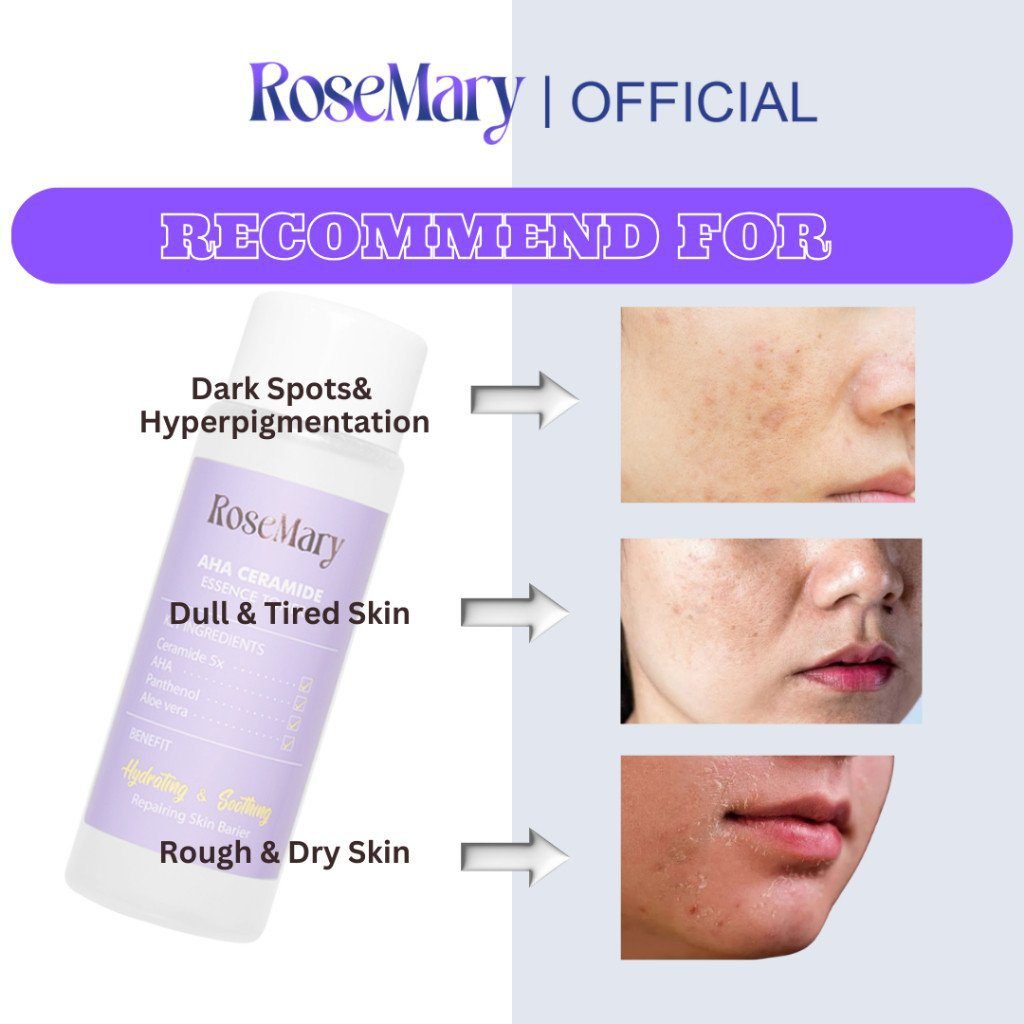 ROSEMARY AHA Ceramide Essence Toner 100 ml | Brightening Toner | Soothing Toner | Barrier toner | Exfoliating toner toner badan face mist hydrating AHA Toner - Gambar 7
